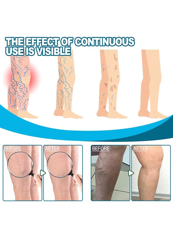 WIYUN Venous Care Cream - Comfortable, smooth, moisturizing and nourishing daily massage cream for leg skin 30g - Image 5